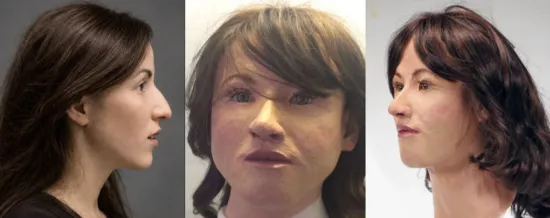 Gezichtsreconstructie van het Heulmeisje dat er in 1976 op ± 14-jarige leeftijd zo uitgezien kan hebben.